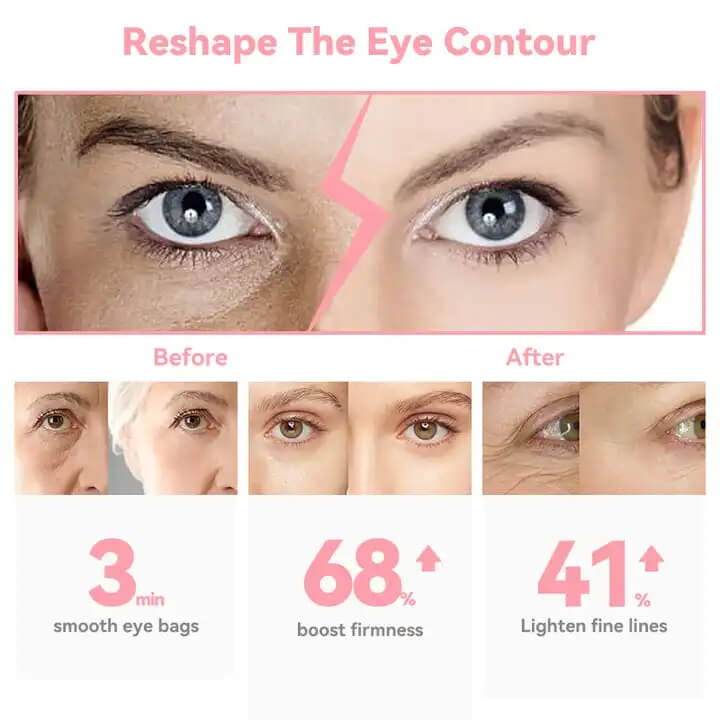 SKB-1807 전열 진동 주름 펜 눈 미용 펜 핫팩 눈 마사지기